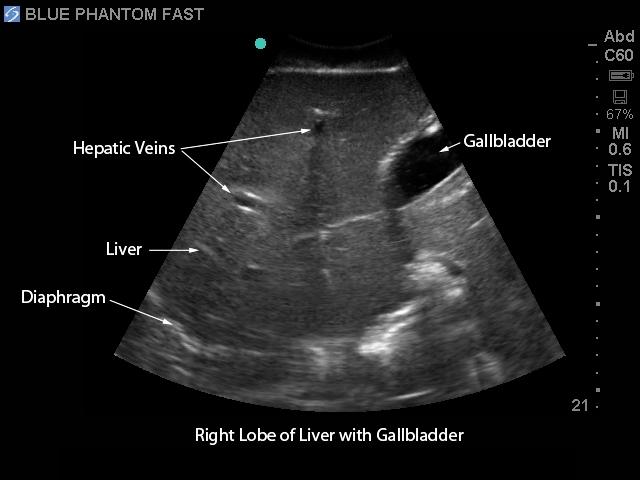 FAST Exam Real Time Ultrasound Training Model - Transthoracic Only for Emergency Medicine & Trauma Assessment Practice (Medical Simulation, Sonography Education, TTE Training)