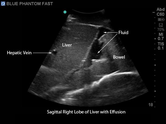 FAST Exam Real Time Ultrasound Training Model - Transthoracic Only for Emergency Medicine & Trauma Assessment Practice (Medical Simulation, Sonography Education, TTE Training)