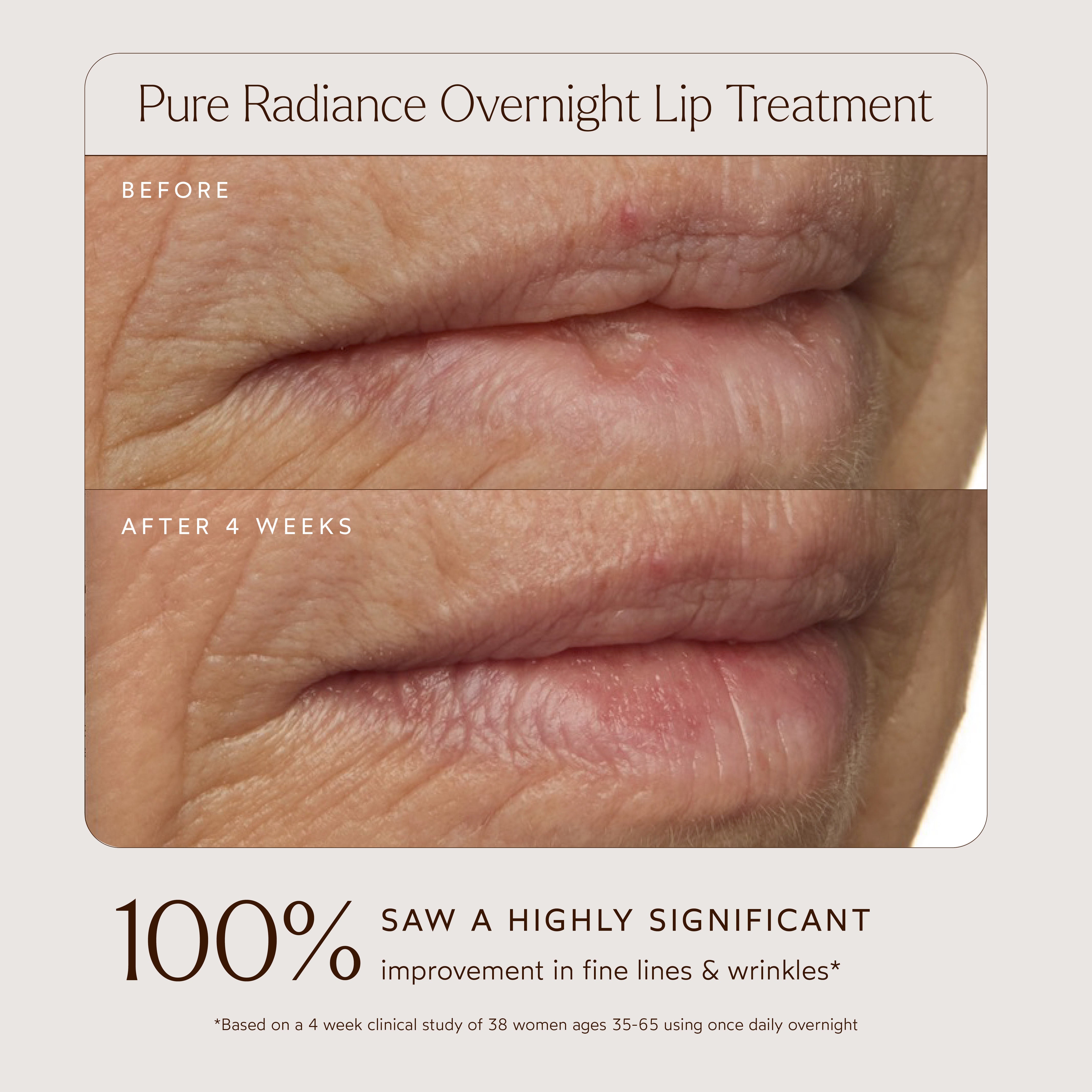 Pure Radiance Overnight Lip Treatment - Hydrating & Plumping Lip Mask for Dry, Chapped Lips | Perfect for Nighttime Skincare Routine & Winter Lip Care