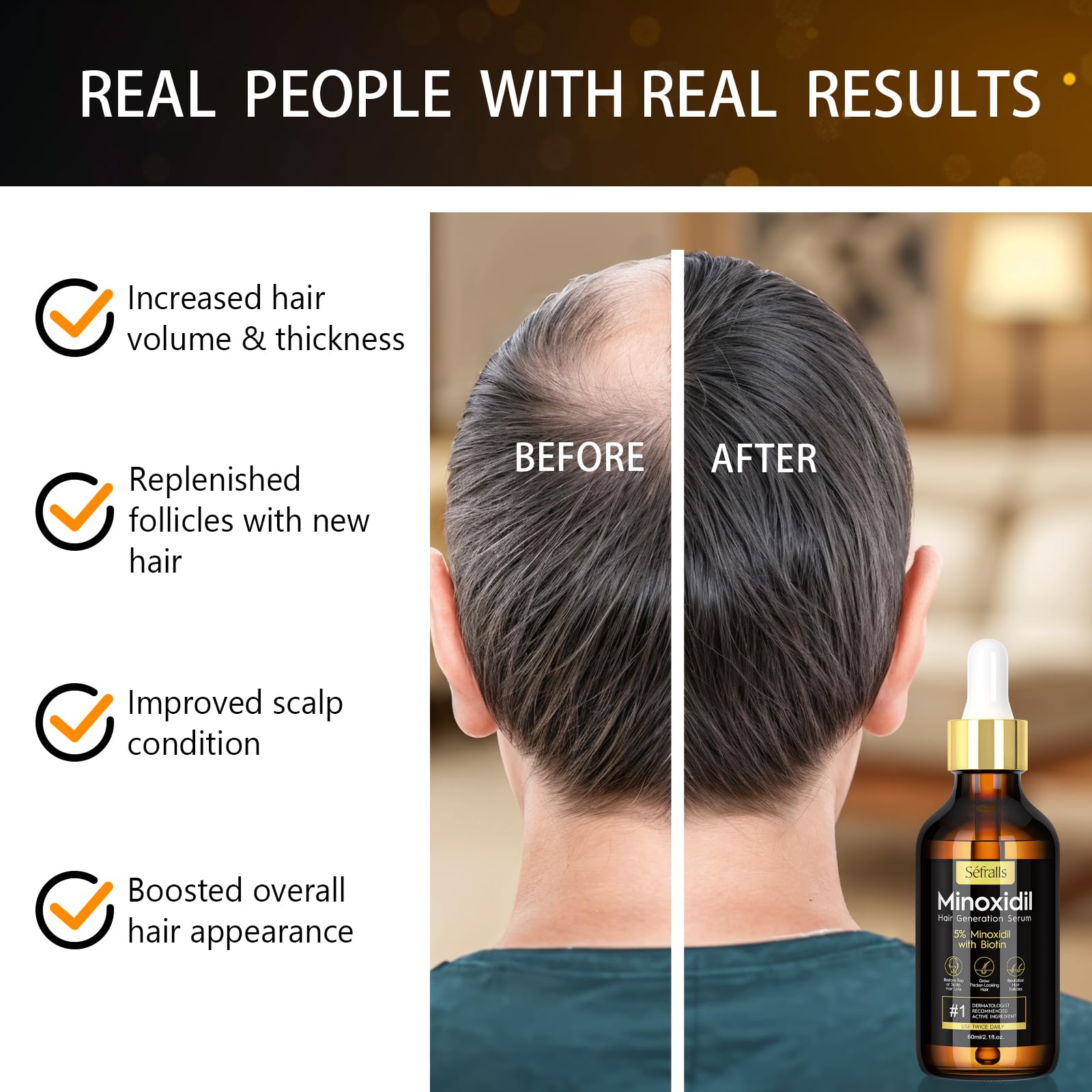 2-Pack 5% Minoxidil Hair Growth Serum for Men & Women - Hair Regrowth Treatment for Stronger, Thicker, Longer Hair - Beard & Facial Hair Growth Solution - Best for Hair Loss Prevention & Thinning Hair Care at Home