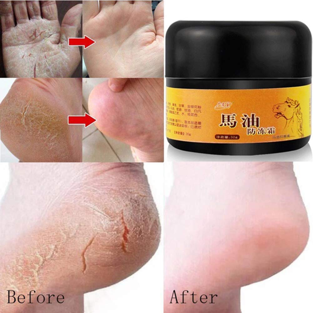 Allbestaye Horse Oil Foot Cream for Dry Cracked Heels - Intensive Repairing Moisturizer for Rough & Chapped Feet - Best for Cracked Heel Treatment & Foot Care at Night