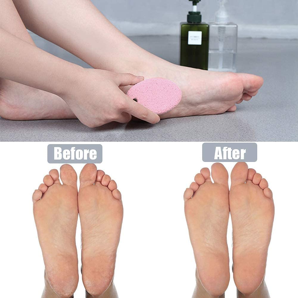 Zhunmun Pumice Stone 2 Pack - Multi-Colored Natural Foot & Hand Exfoliator for Women - Callus Remover & Hard Skin Scrubber - Perfect for Pedicure, At-Home Spa & Dry Skin Care