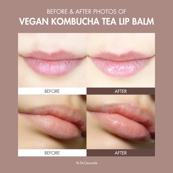 Dr. Ceuracle Vegan Kombucha Tea Lip Balm 3.7g - Cruelty Free Hydrating & Nourishing Lip Care for Dry, Cracked, Chapped Lips - Infused with Shea Butter & Botanical Squalene from Olives - Not Tested on Animals - Perfect for Daily Lip Moisturizing, Winter Care & On-The-Go Lip Protection