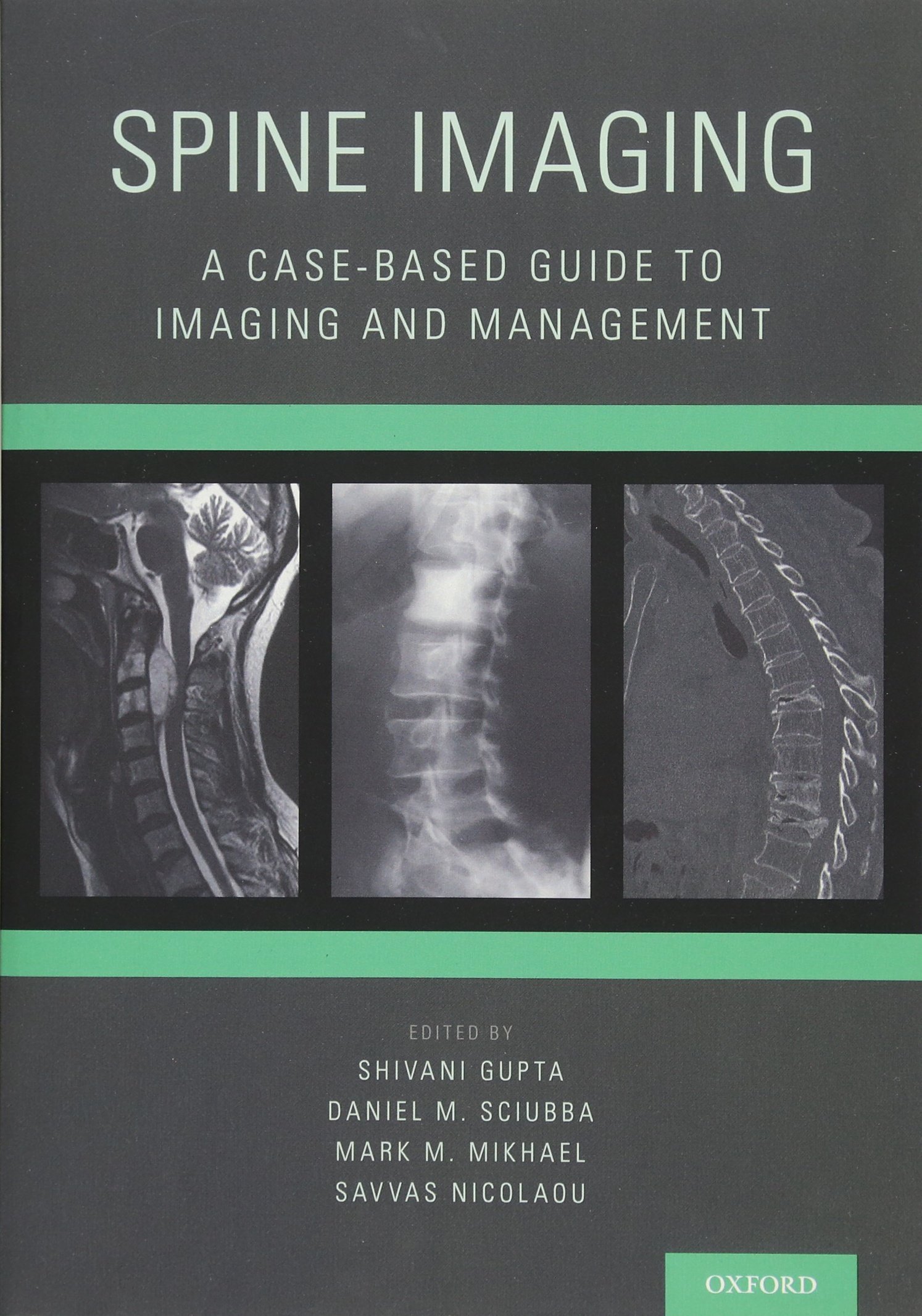 Spine Imaging Guide: Case-Based Radiology & Management for Doctors - Essential for Diagnostics & Treatment Planning