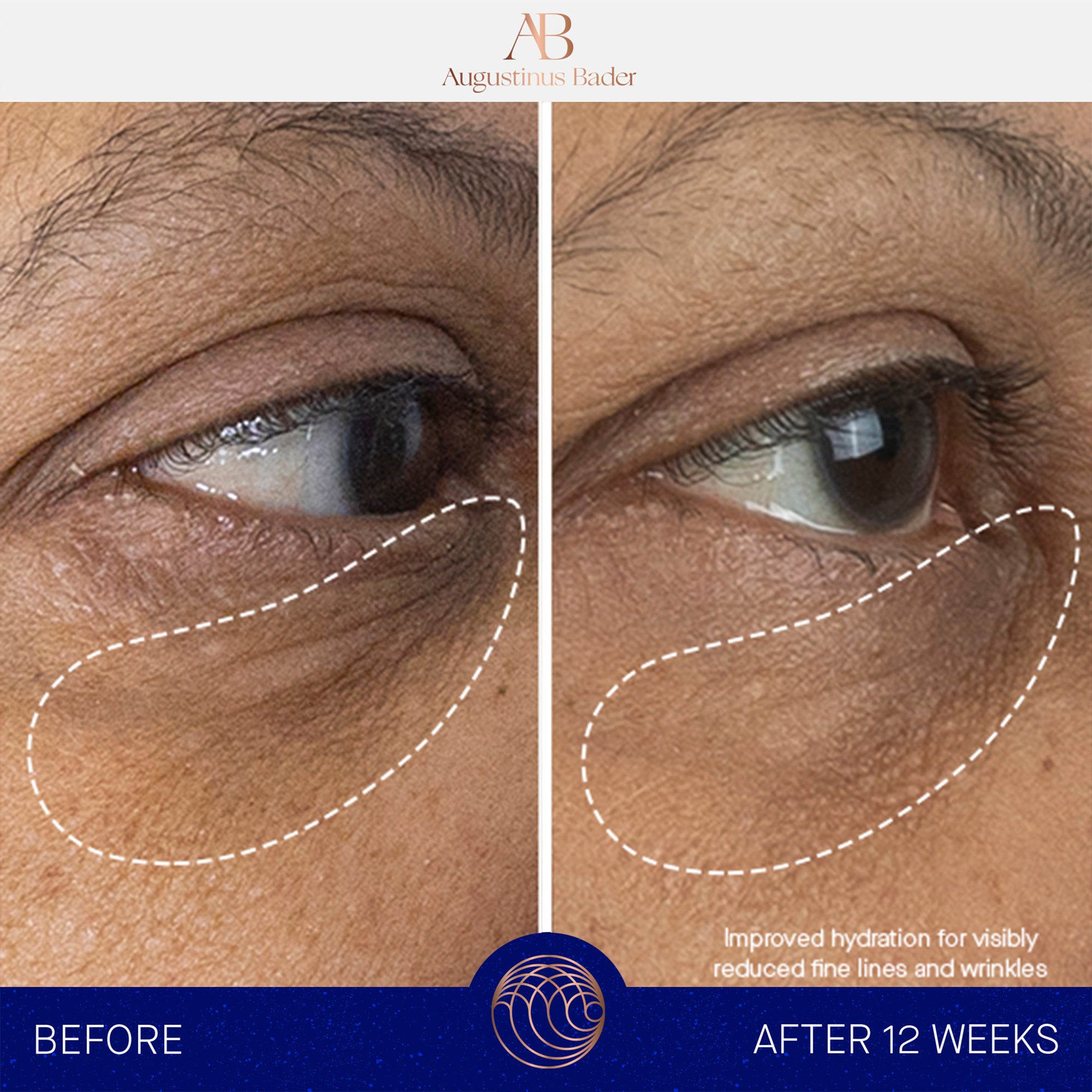 TFC8® Eye Cream - 15ml Dark Circle & Wrinkle Treatment for Women & Men - Perfect for Night & Day Use