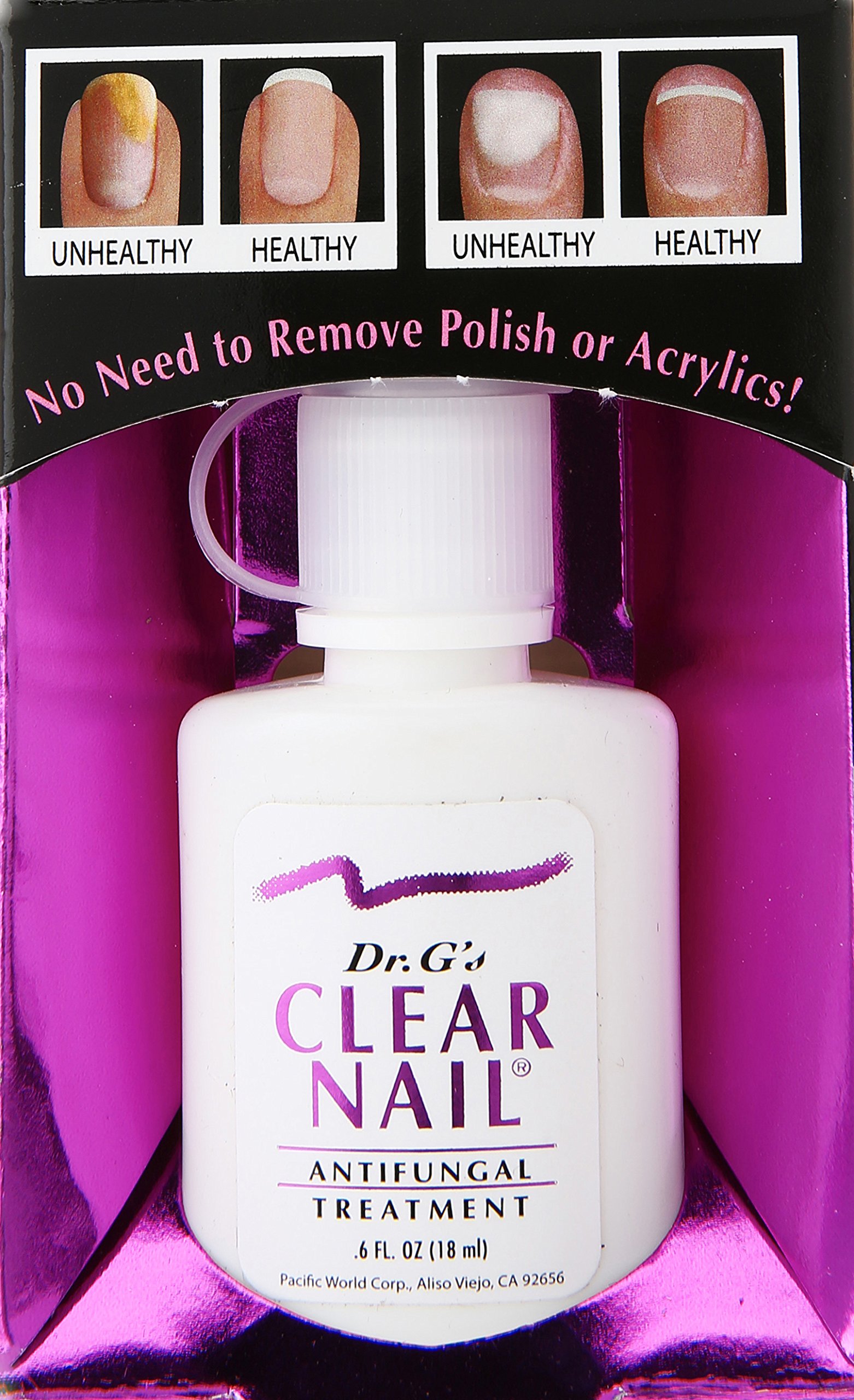 Dr. G's Clear Nail Antifungal Treatment for Toenail & Fingernail Fungus - 0.6 oz Medicated Solution | Fast-Acting Formula for Healthy Nails | Ideal for Athletes, Swimmers & Diabetics