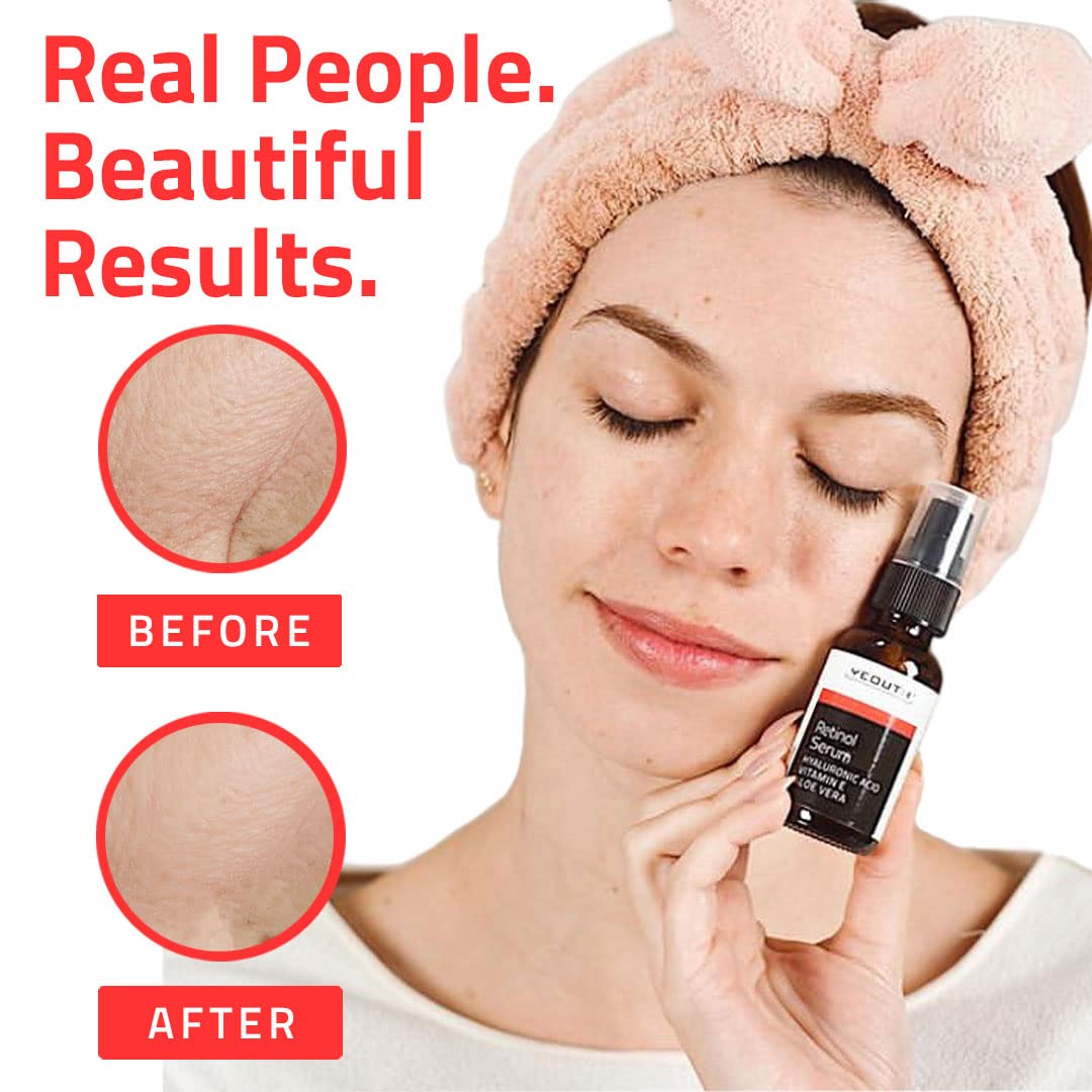 YEOUTH Retinol Serum with Hyaluronic Acid - Anti-Aging Face Serum for Wrinkles, Dark Spots & Acne - Hydrating Skin Care for Men & Women - Perfect for Night Routine & Daily Moisturizing