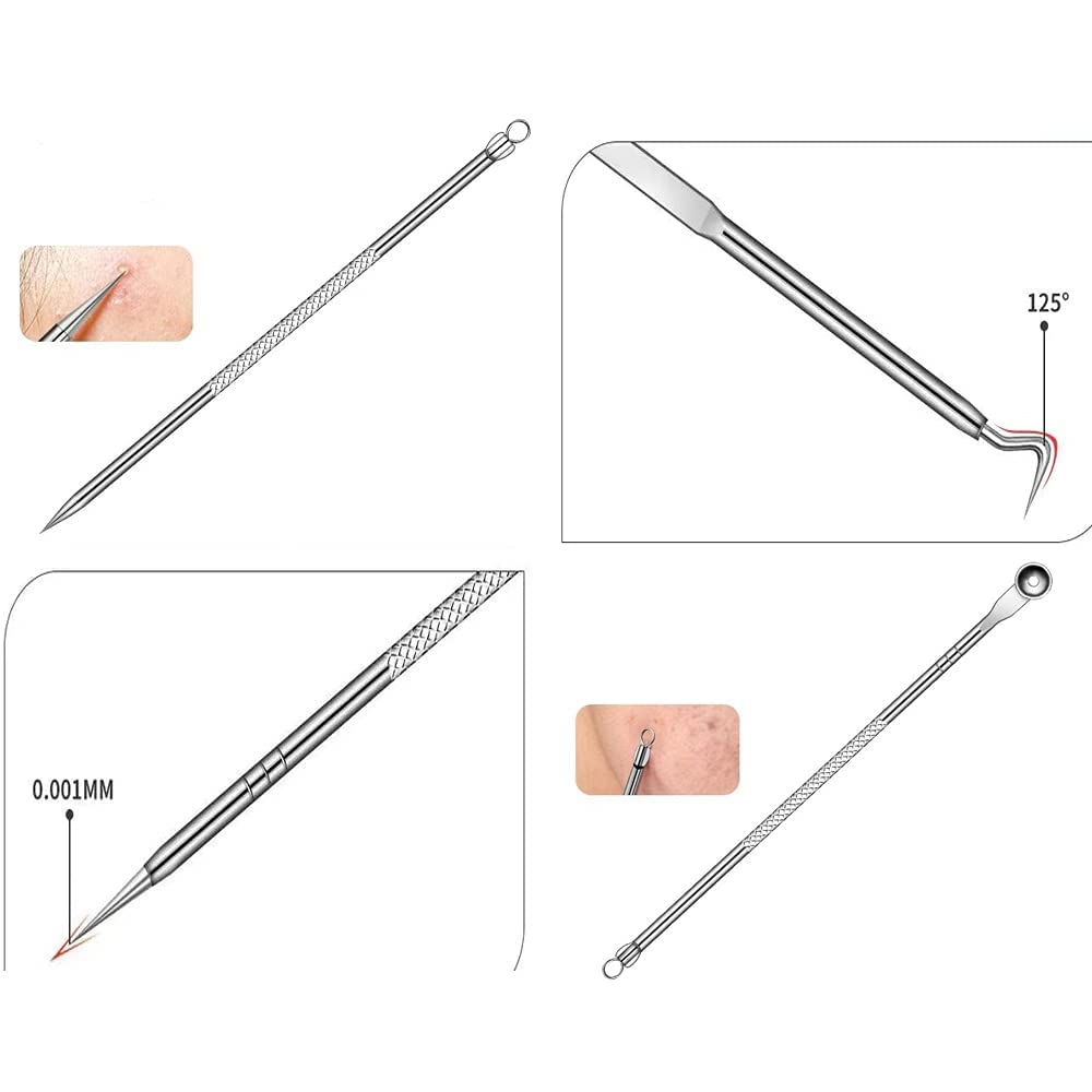 4-Piece Stainless Steel Blackhead Remover Kit - Pimple Popper, Comedone Extractor & Whitehead Removal Tools for Nose & Face | Acne Treatment & Skincare Routine