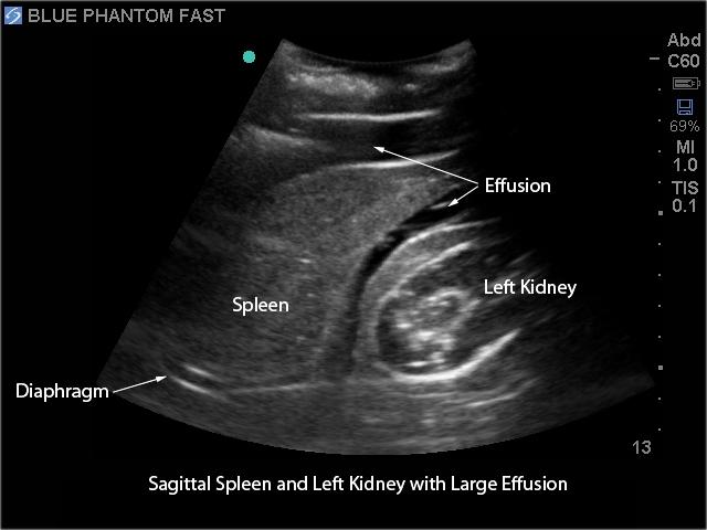 FAST Exam Real Time Ultrasound Training Model - Transthoracic Only for Emergency Medicine & Trauma Assessment Practice (Medical Simulation, Sonography Education, TTE Training)