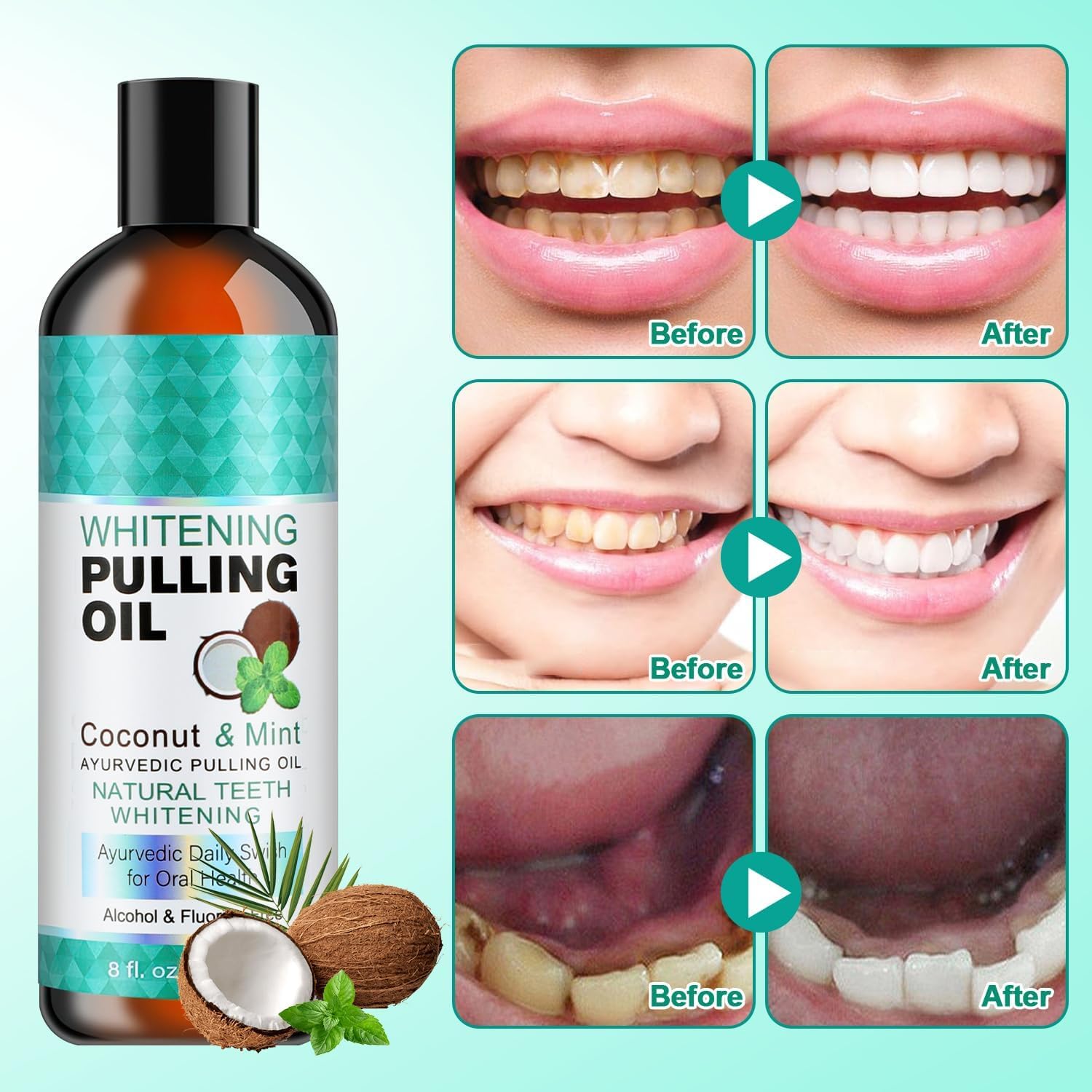 Organic Coconut Oil Pulling for Fresh Breath & Oral Hygiene - Natural Teeth Whitening, Healthy Gums Support with Tongue Scraper - 8 fl oz - Perfect for Morning Routine & Ayurvedic Dental Care