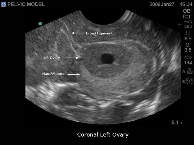 General Pathology Transvaginal Ultrasound Training Model - High-Quality Medical Simulation for OB/GYN Education & Clinical Practice - Perfect for Medical Schools, Hospitals & Diagnostic Labs