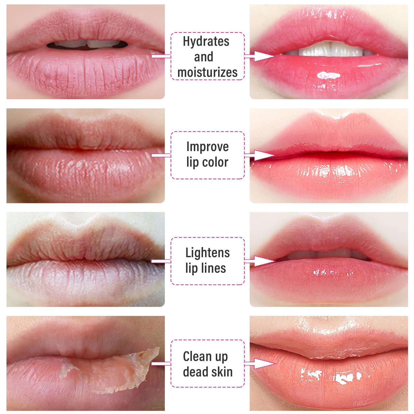 30 PCS Collagen Lip Masks for Dry Lips - Hydrating Gel Lip Mask Sheets to Remove Dead Skin, Moisturize & Lighten Lip Lines (Gold) | Perfect for Night Care, Travel & Winter Lip Treatment