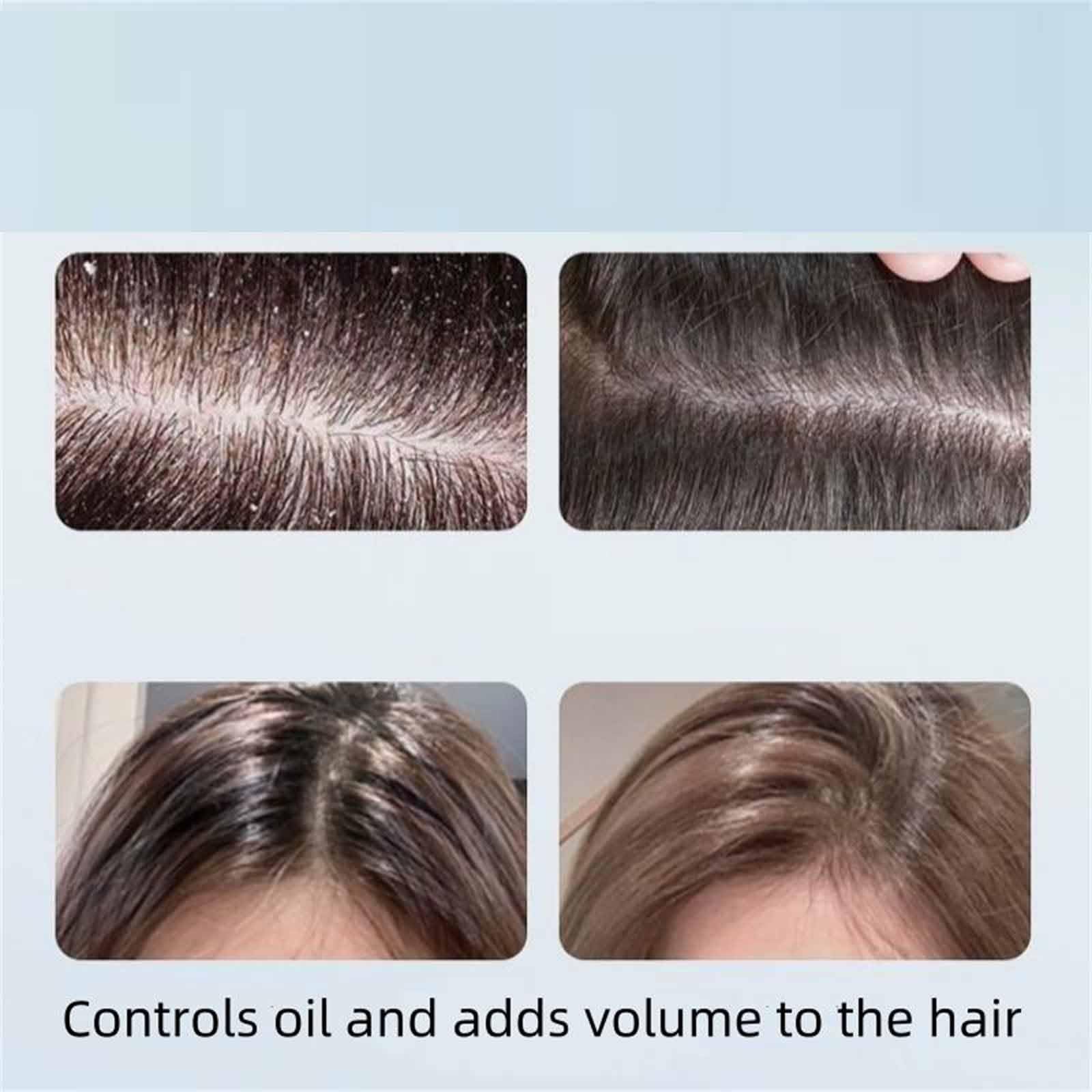 Nipori Anti-Dandruff Shampoo for Men & Women - 300ml Deep Moisture Refreshing Hair Care with Oil Control & Cleansing Formula (2 Pack) - Perfect for Daily Scalp Care & Dandruff Prevention at Home or Gym