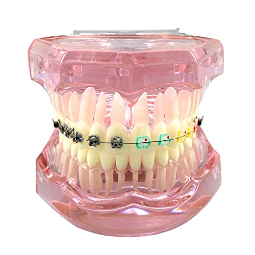 Dental Teeth Model for Orthodontic Demonstration & Training - M3012 (1Pc) | Perfect for Dental Students, Dentists & Orthodontic Practices - Ideal for Teaching, Learning & Clinical Demonstrations