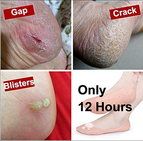 R A Products Anti Crack Full Length Silicone Foot Protector Moisturizing Socks for Dry Cracked Feet & Heel Pain Relief - Best for Overnight Foot Care, Diabetic Foot Therapy & Cracked Heel Treatment (Full Length)