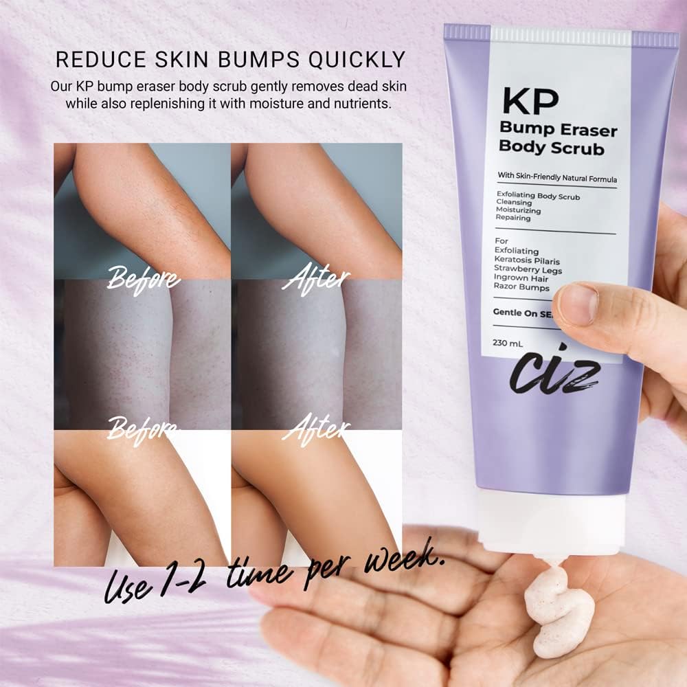 KP Bump Eraser Body Scrub - Exfoliating Body Scrub for Women with Strawberry Scent | Effective KP Treatment for Strawberry Legs & Bumpy Skin | Perfect for Shower, Pre-Shave & Post-Waxing Care