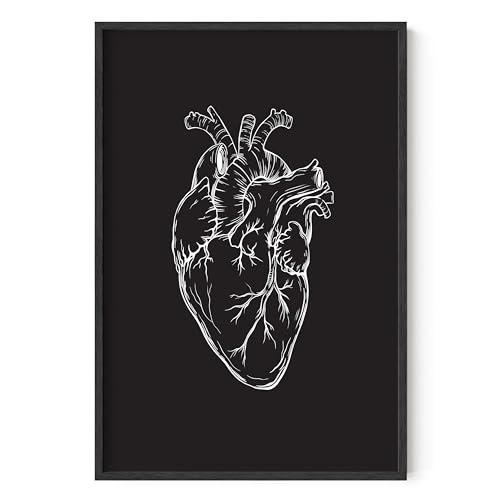 Black Heart