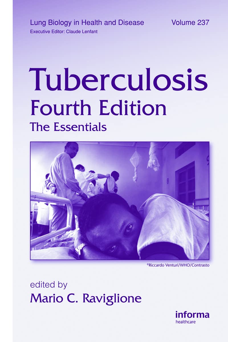 Tuberculosis: The Essentials, 4th Edition - Comprehensive Guide to Lung Biology & Disease Treatment | For Medical Students, Doctors & Healthcare Professionals