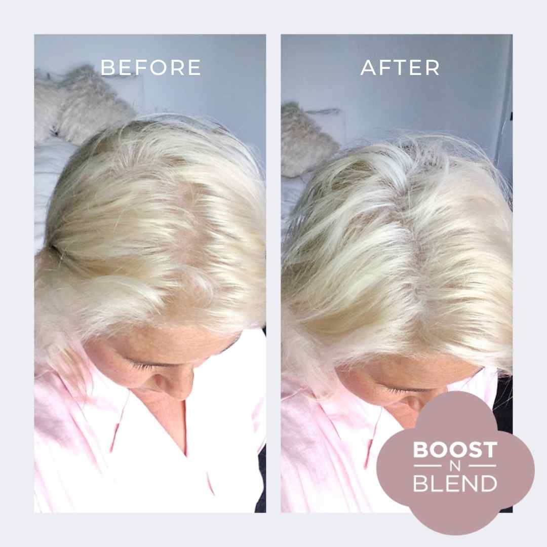 Premium Female Hair Fibers - 25g Bottle for Thinning Hair & Instant Volume | Natural-Looking Coverage for Bald Spots & Hair Loss | Perfect for Daily Use, Special Occasions & Confidence Boosting