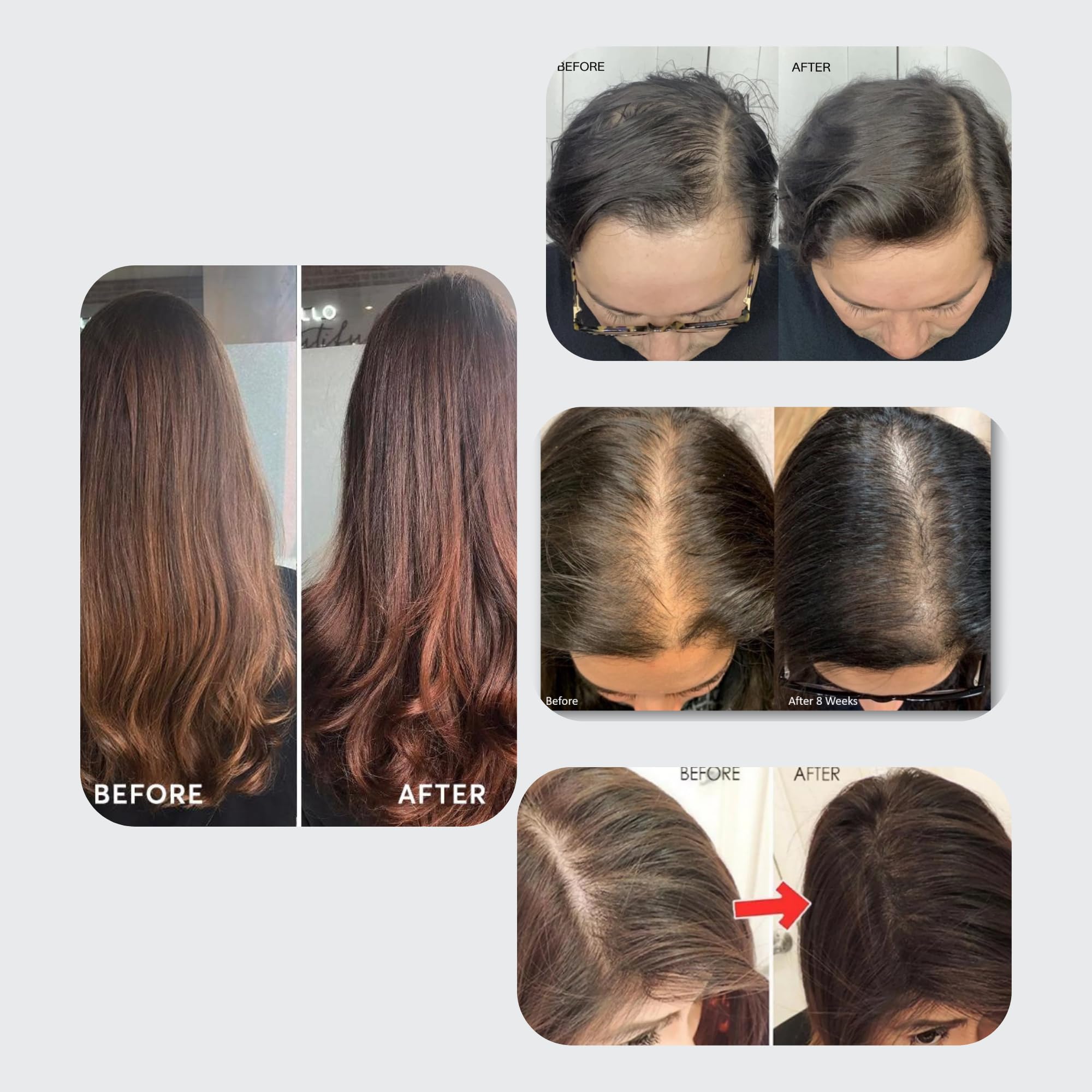 Dr. Sebi Batana Oil for Hair Growth & Scalp Treatment - 100% Raw Organic Hair Oil from Honduras | 6 Month Supply (1 Litre) | Repairs Dry Damaged Hair, Split Ends & Prevents Hair Loss | Perfect for Daily Hair Care Routine & Natural Hair Regrowth