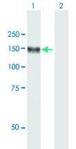 Anti-LNPEP Mouse Polyclonal Antibody (50μg) - High-Quality Research Antibody for Western Blot, ELISA, and Immunohistochemistry - Ideal for Lab Research and Biomedical Studies