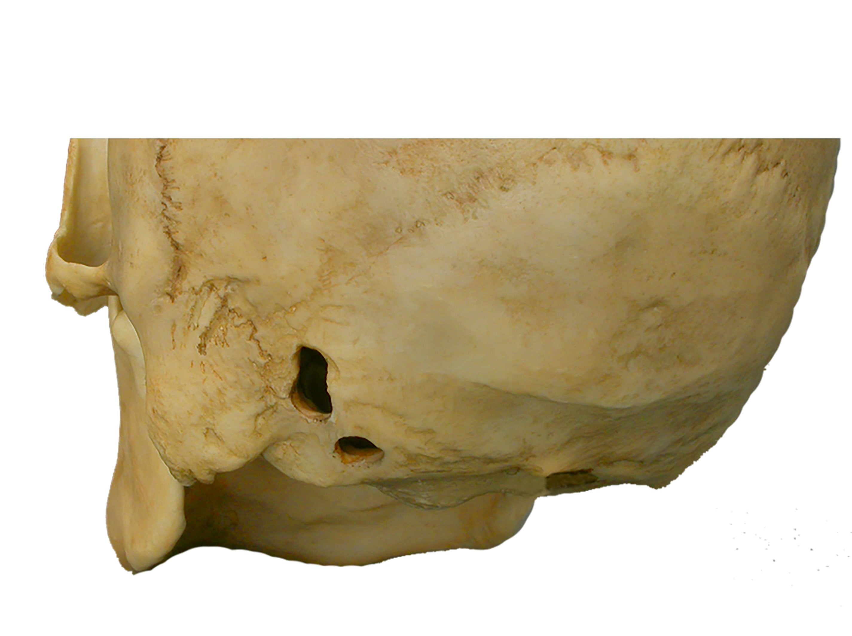 Realistic Human Skull Replica with Multiple Gunshot Wounds - Anatomical Model for Medical Training, Halloween Decor, and Horror Movie Props