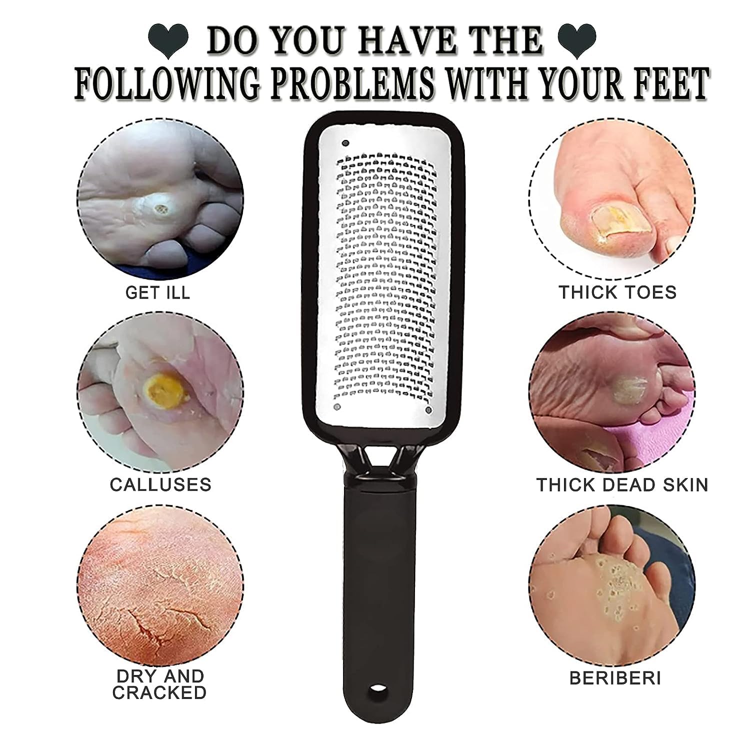 Voxmix Stainless Steel Callus Remover & Foot Scrubber - Professional Pedicure Tool for Dead Skin Removal | Pack of 1 in Black | Perfect for Home Spa, Salon Care & DIY Foot Care Routine