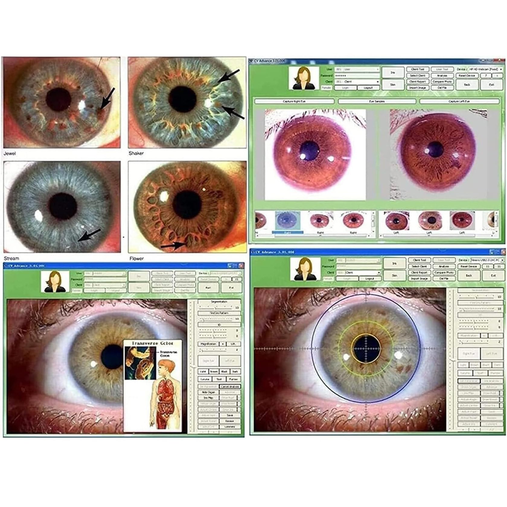 Automatic Iris Detector Camera - Professional Iridology Analysis Tool with Adjustable Focus for Eye Health Diagnosis | Perfect for Naturopaths, Holistic Practitioners & Eye Care Specialists