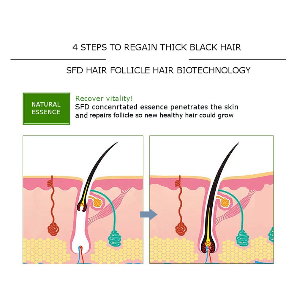 Natural Hair Growth Serum with Ginger Essential Oil - Anti Hair Loss Treatment for Healthy, Strong & Thick Hair | Stimulates Follicles, Reduces Breakage & Revitalizes Scalp | Perfect for Thinning Hair, Baldness & Brittle Hair Care at Home