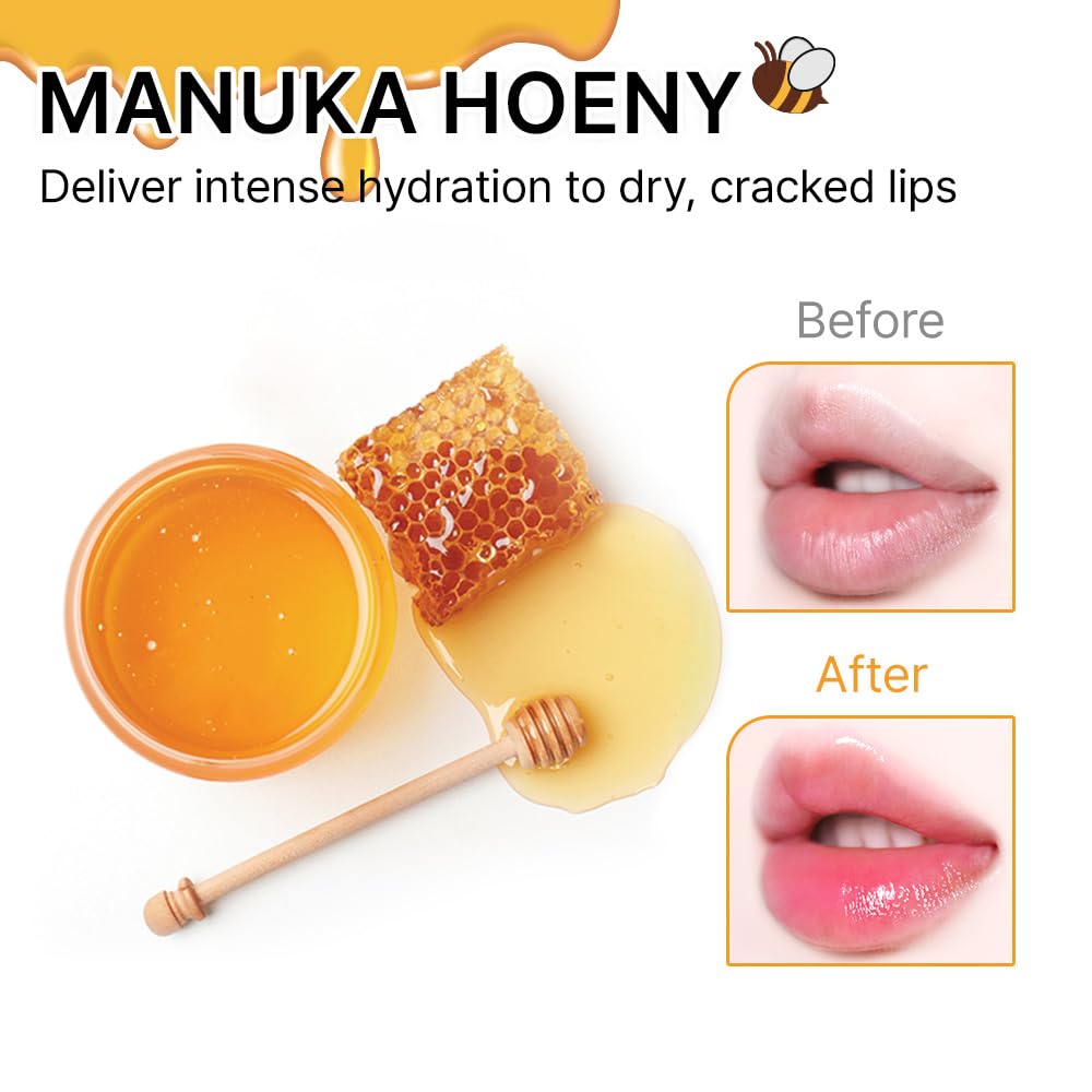 YNM Candy Honey Lip Balm - Non-Sticky, High-Shine, Moisturizing with Manuka Honey for Fuller Lips | Day & Night Care