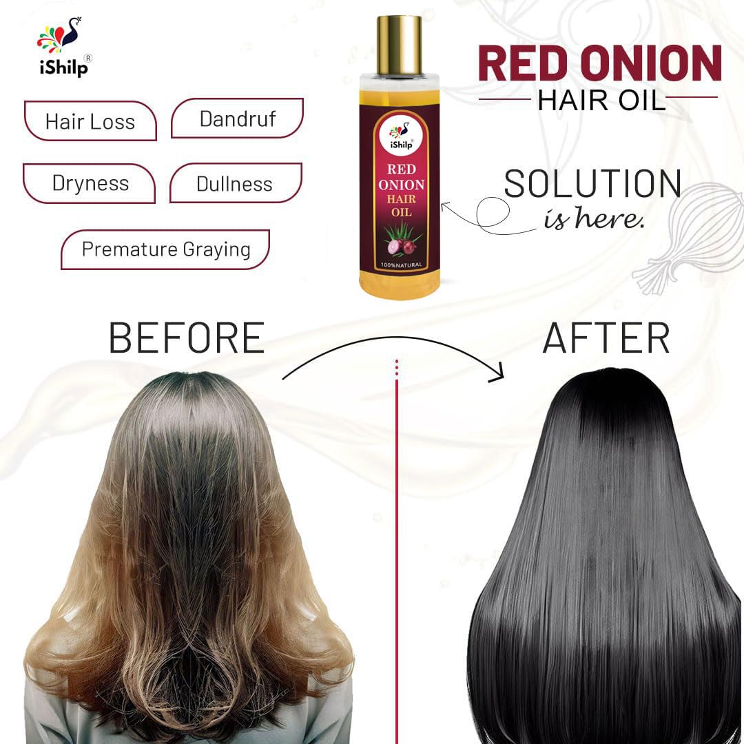 iShilp Red Onion Hair Oil for Shiny & Healthy Hair Growth | 100% Natural Onion Oil Treatment for Long, Strong & Beautiful Hair - 100ml | Perfect for Daily Hair Care & Scalp Nourishment at Home