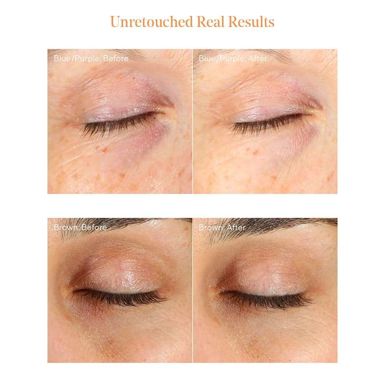 Murad Environmental Shield Vitamin C Eye Cream for Dark Circles - Brightening & Hydrating Under Eye Treatment for Dark Circles & Puffiness - Perfect for Morning & Night Skincare Routine