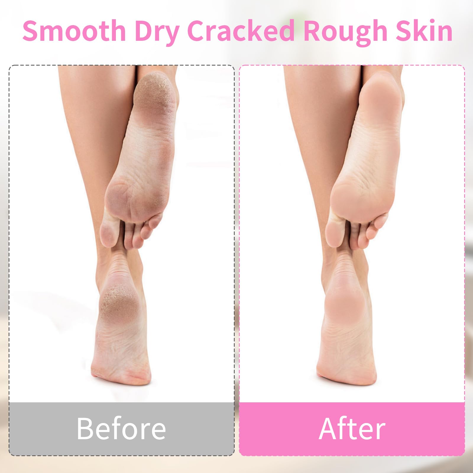 Moisturizing Socks for Women - 10 Pairs Cotton Spa Foot Care Socks with Lotion for Dry & Cracked Feet - Overnight Hydrating Gel Socks for Soft Skin - Perfect for Home Spa, Night Treatment & Cracked Heel Repair