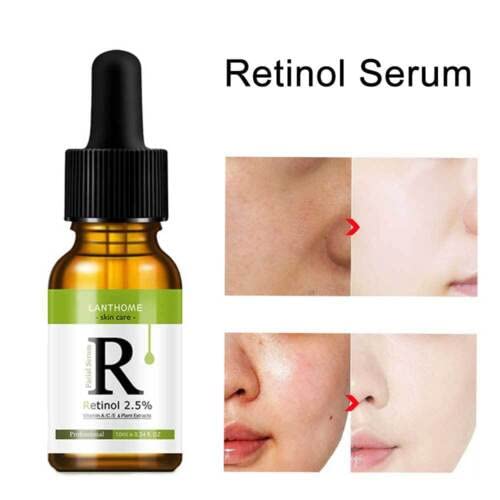 2.5% SRS Retinol Serum with Vitamin A, C & E - Anti-Aging, Acne Treatment & Wrinkle Removal Face Serum (10ml) | Brightens Skin & Reduces Fine Lines - Perfect for Nighttime Skincare Routine