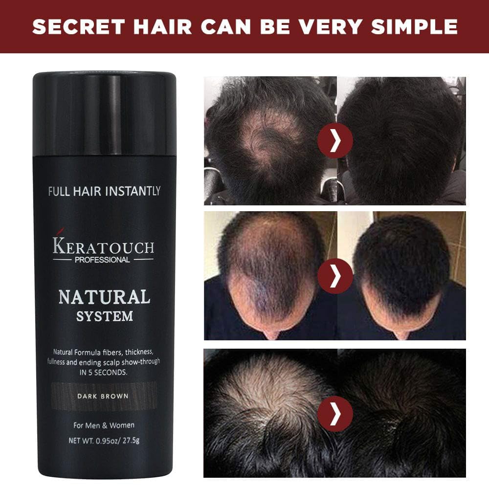 KERATOUCH Hair Building Fibers for Thinning Hair & Bald Spots - Natural Keratin Hair Fibers for Men & Women (Brown, 27.5g) - Instant Hair Volume Solution for Daily Styling & Confidence Boost