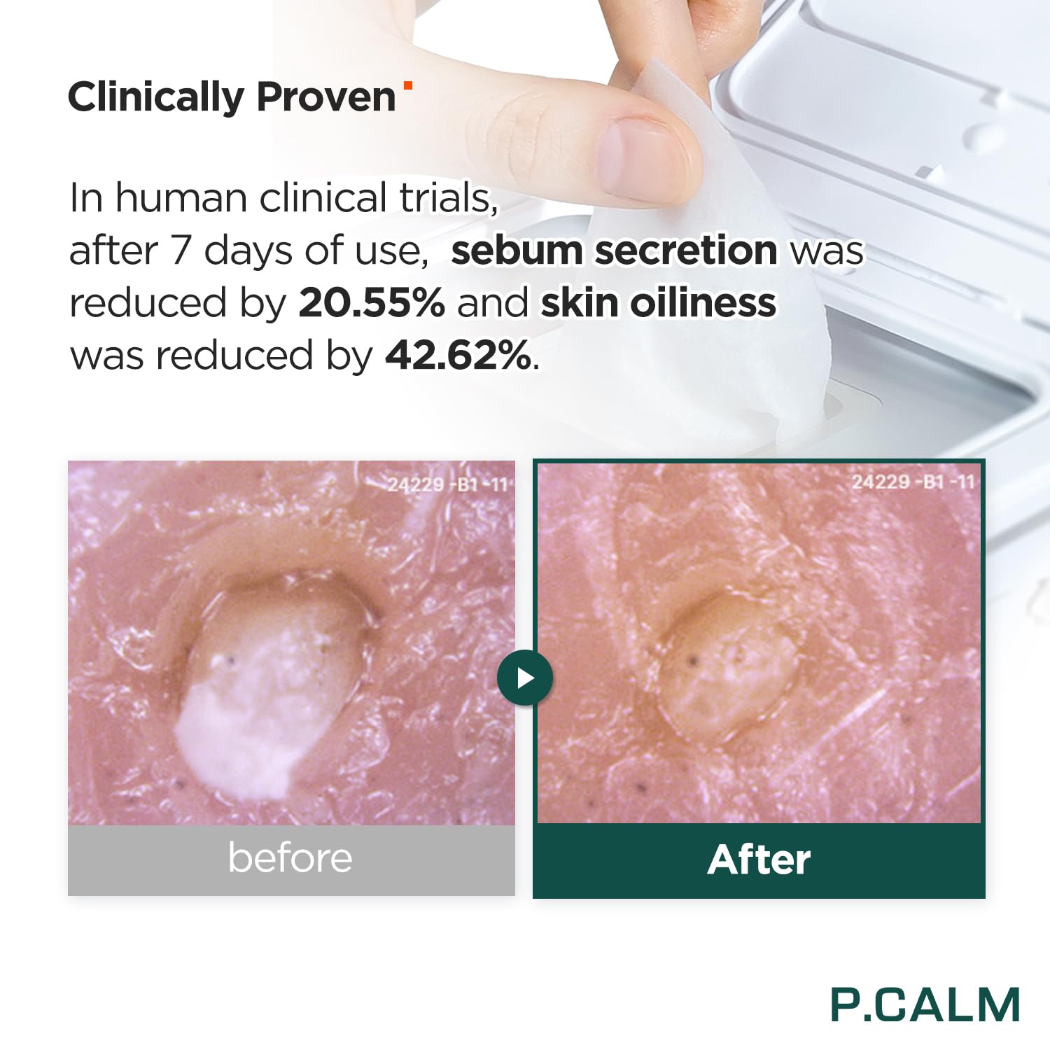 P.CALM Skin Barrier Boost Essentials – Korean Non-Comedogenic Skincare for Sensitive Skin | Vegan & Cruelty-Free | Daily Hydration & Redness Relief for Dry, Irritated Skin
