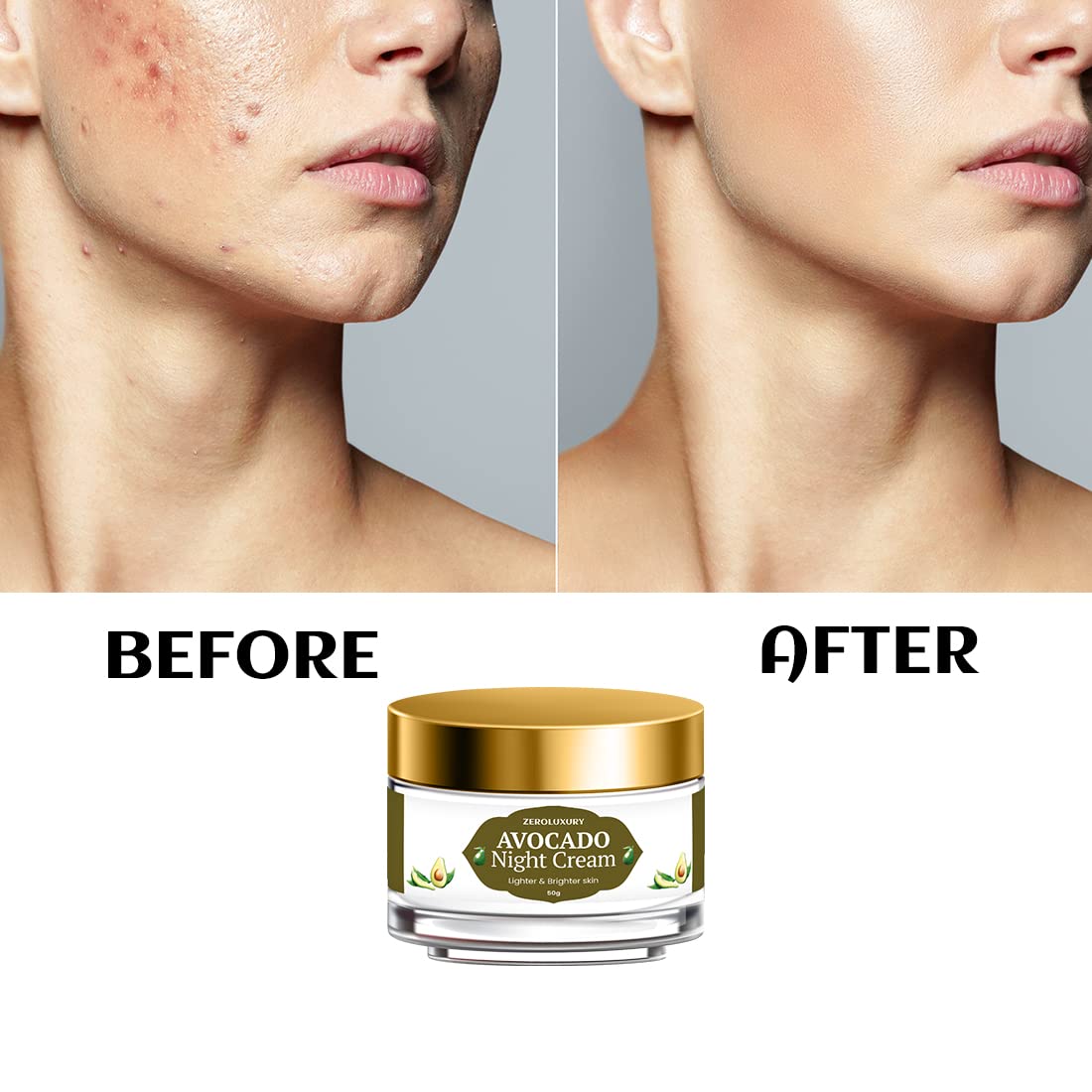 ZeroLuxury Avocado Night Cream - Deep Nourishing & Overnight Repair for Glowing Skin - 50g (Pack of 2) - Perfect for Summer Skin Prep & Nighttime Skincare Routine