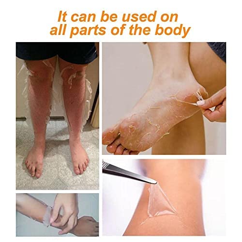 2PCS Orange Peeling Lotion - Exfoliating Body & Face Gel for Dead Skin Removal on Neck, Knees & Feet | Gentle Instant Exfoliator for Smooth Skin - Perfect for Spa Days & At-Home Skincare Routine