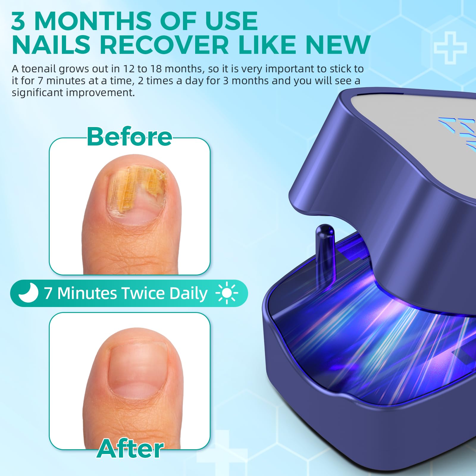 Best Nail Fungus Laser Treatment Device with LED Light - FSA/HSA Eligible for Toenail & Fingernail Fungal Infections | Restores Healthy Nails Fast | Home Use for Athletes, Seniors & Diabetics