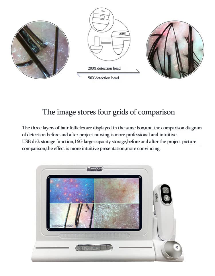 Professional Skin & Hair Detector - 11 Inch Scalp Hair Follicle Analyzer with Moisture & Pores Detection | Skin Pigment Tester | Perfect for Dermatologists, Salons & Home Skin Care