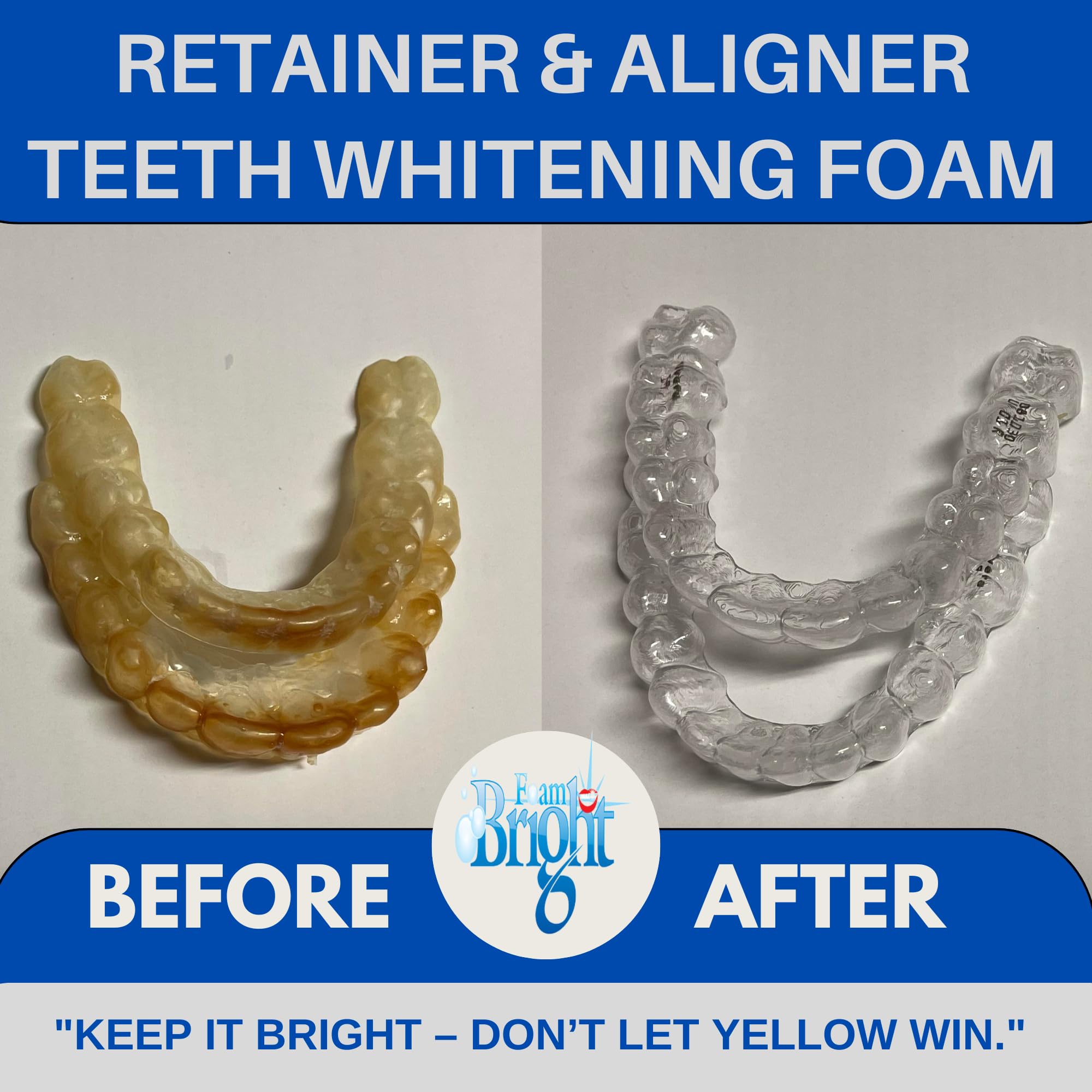 **Bright Retainer & Aligner Cleaner Foam – Peroxide-Free Teeth Whitening for Invisalign, Candid, Byte, Dentures & Braces – Gentle Oral Care Alternative to Tablets & Paste – Perfect for Daily Cleaning & Travel**