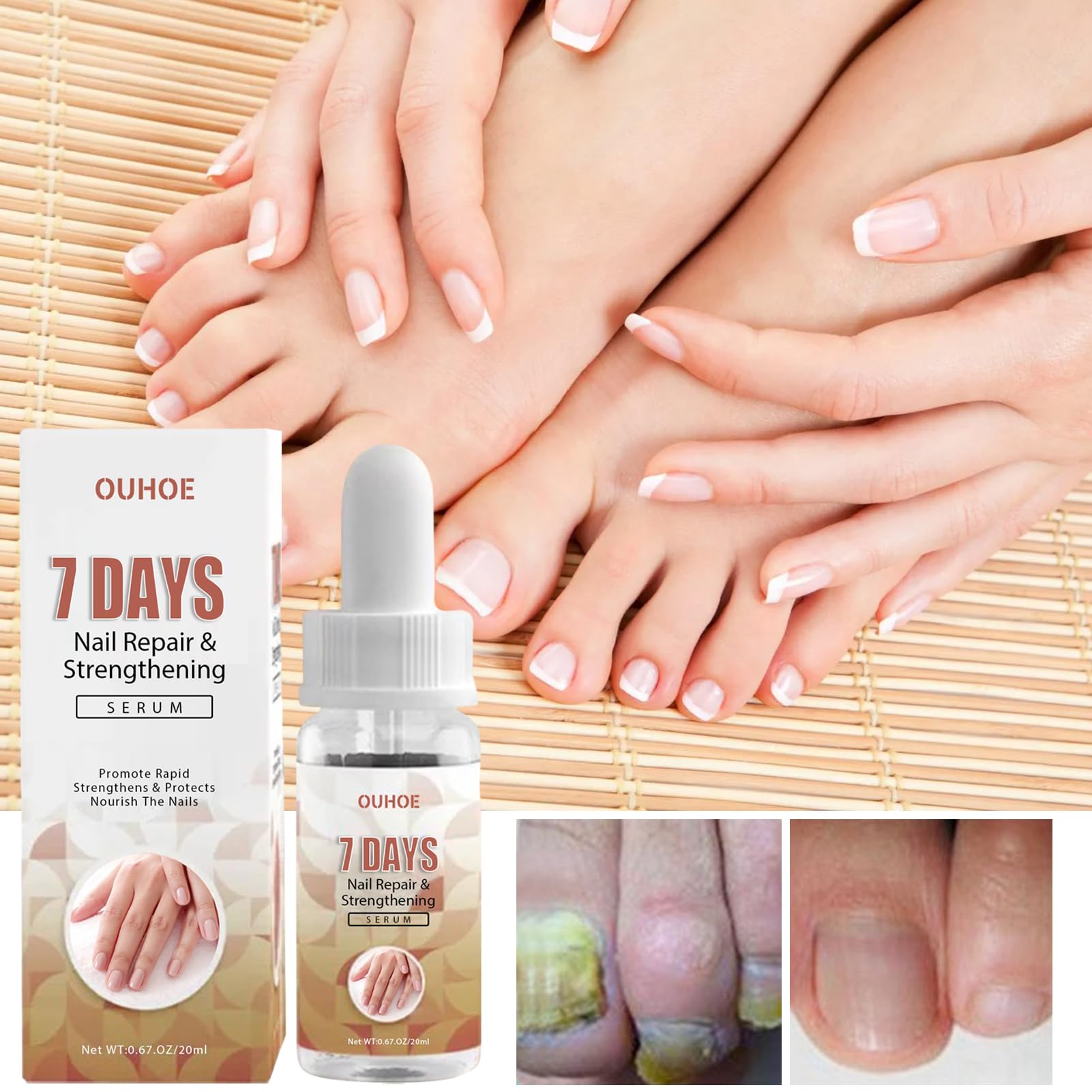 Best Nail Strengthening Cream & Repair Essence - Multi-Purpose Nail Growth Treatment for Damaged, Weak & Brittle Nails - Perfect for Salon, Home Care & Travel