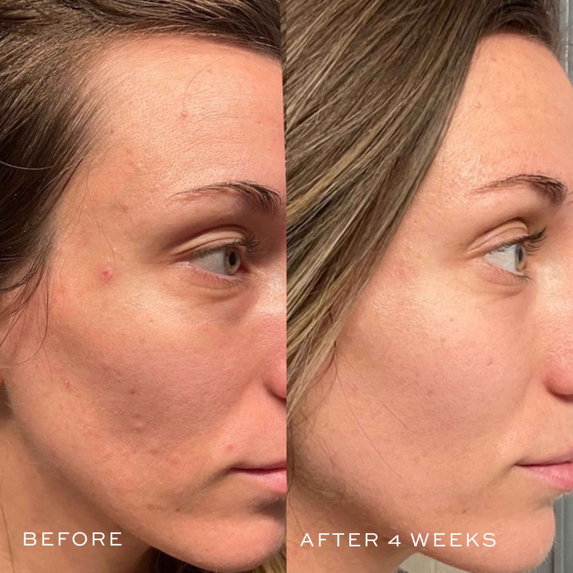 Jumbo Hyaluronic Acid Serum for Face - 2oz Anti-Aging Hydrating Facial Moisturizer - Deep Wrinkle Treatment & Skin Plumping - Perfect for Dry Skin & Night Care Routine