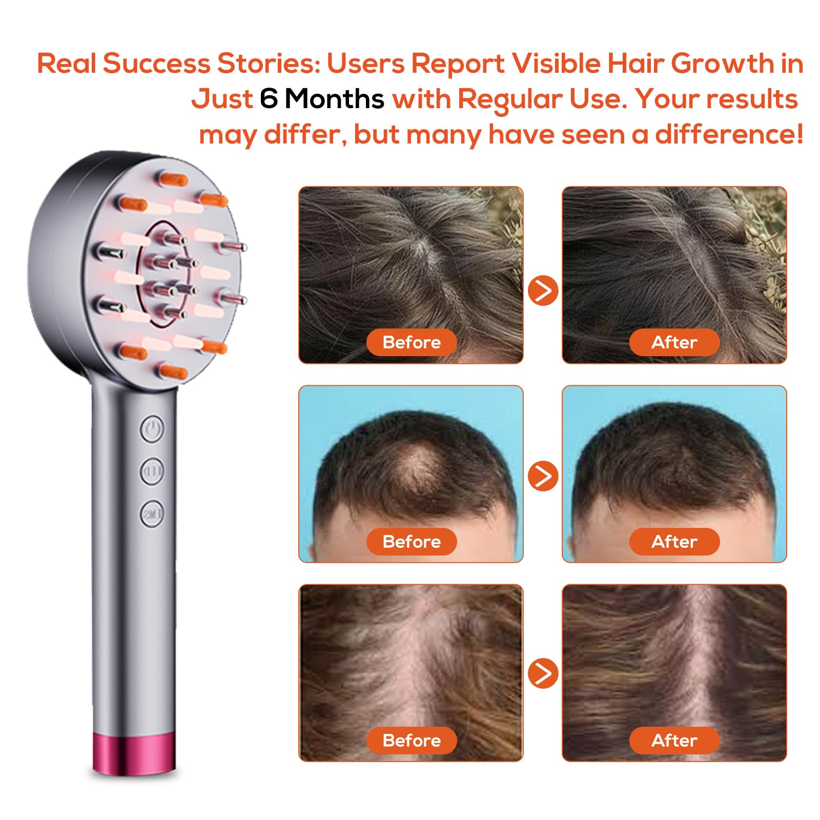 Laser Hair Growth Comb for Men & Women - Red Light Therapy Scalp Massager for Hair Loss Treatment & Stimulation - Electric Hair Regrowth Device for Thicker Fuller Hair - Perfect for Home Use & Salon Treatments