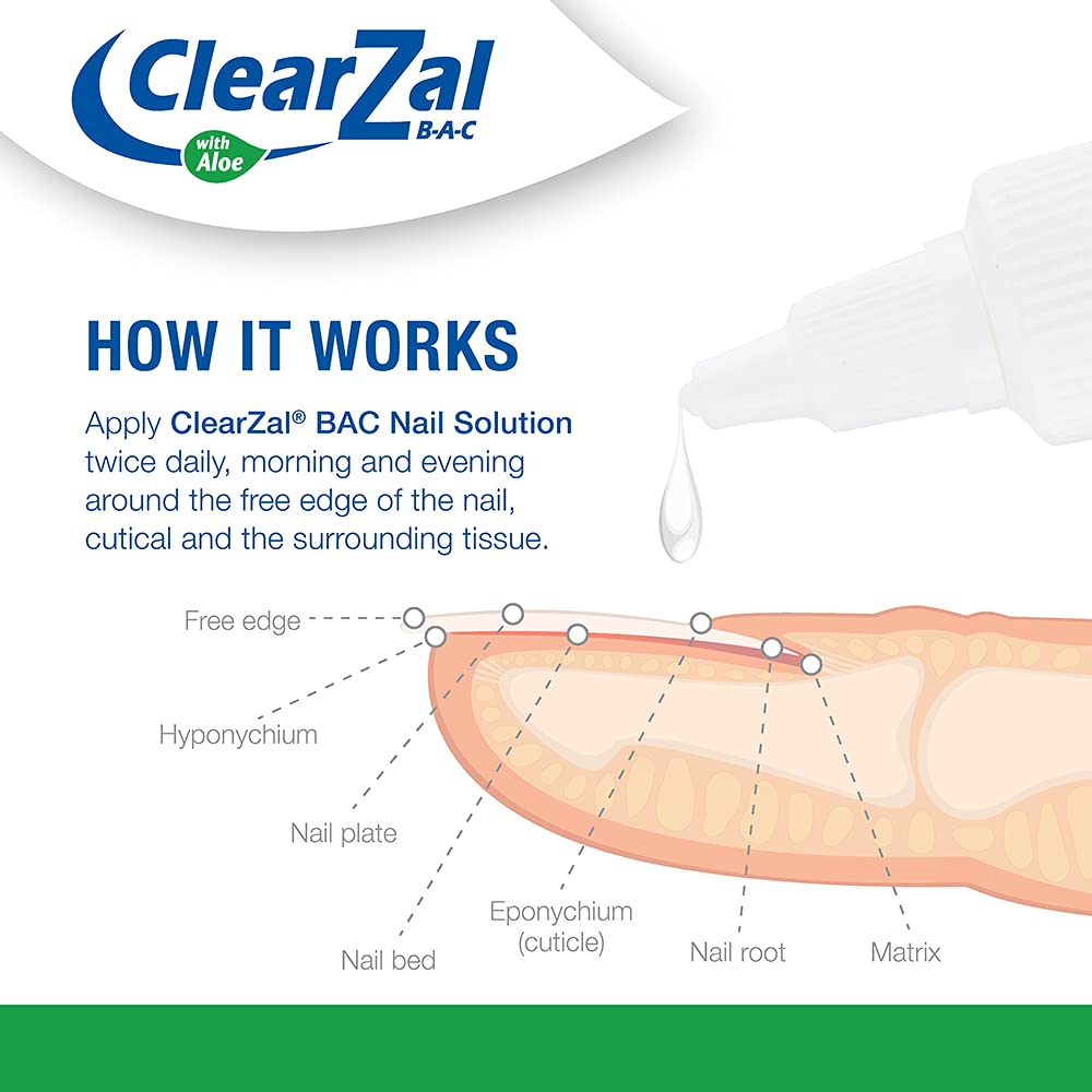 ClearZal Fungal Nail Treatment - Antimicrobial Nail Solution 30ml | Kills Toenail & Fingernail Fungus, Bacteria, Viruses | Doctor-Recommended | Triple Pack for Home, Travel & Gym Use