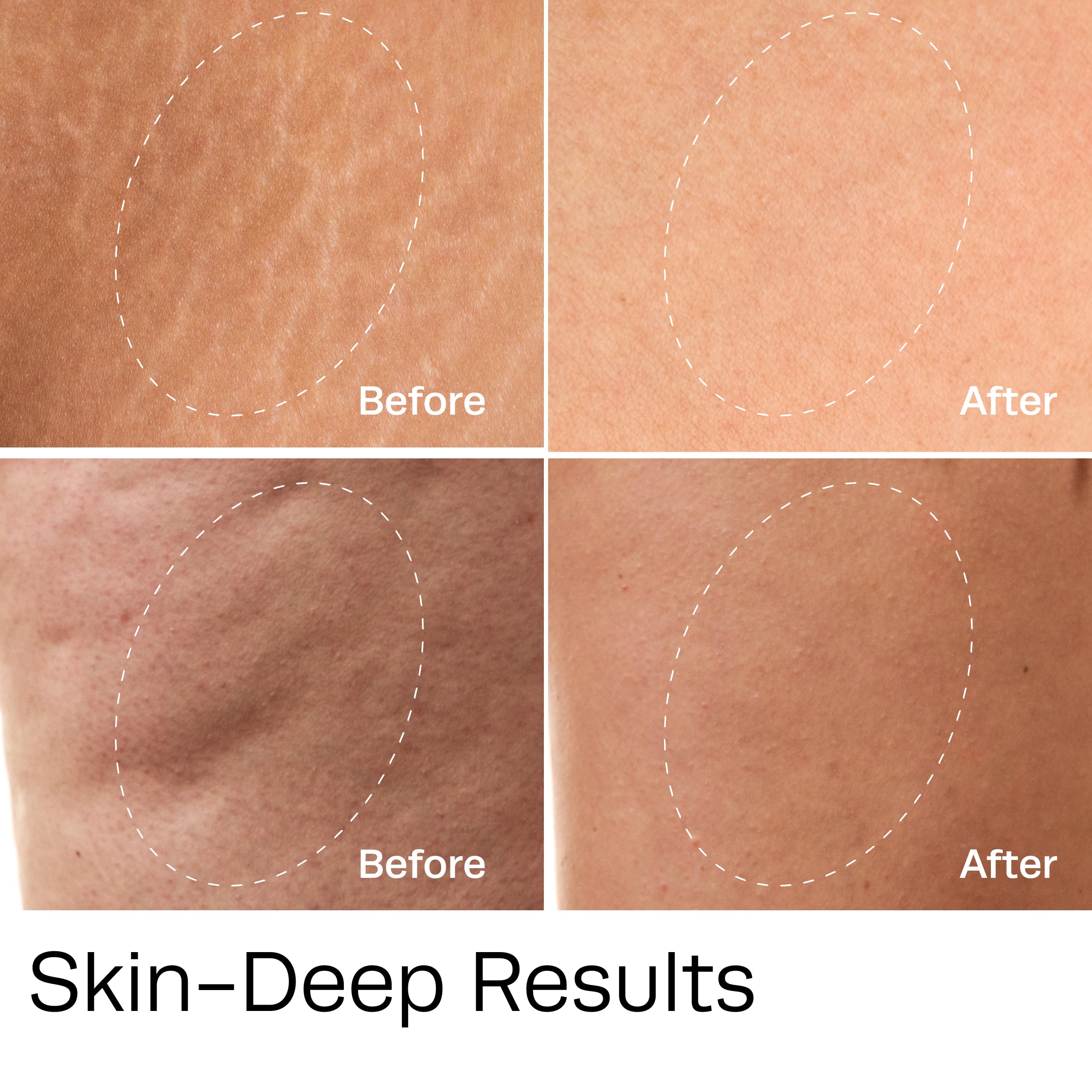 Hot Vita Vitamin C Body Serum – Hydrating & Firming Natural Blend with Rosehip & Cypress Oils – Evens Skin Tone, Reduces Cellulite, Boosts Radiance & Collagen – Perfect for Dry Skin & Anti-Aging Routine