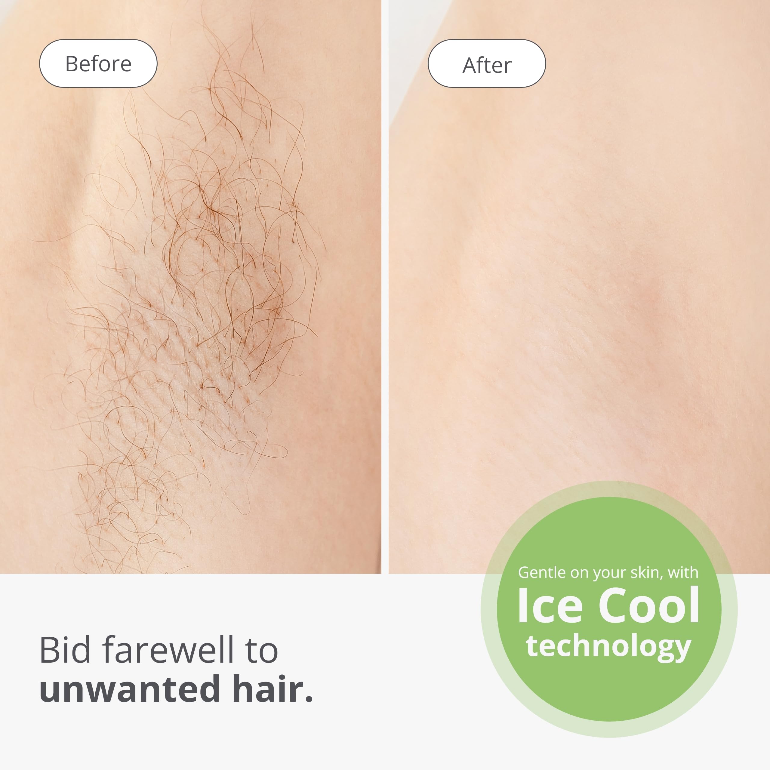 Tria Beauty IPL Hair Removal Device - Permanent Hair Removal for Legs, Bikini & Body - At-Home Laser Hair Removal System with Intense Pulsed Light Technology - Smooth Skin for Summer, Beach & Special Occasions