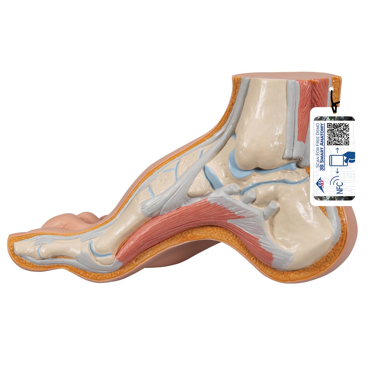Best Orthotic Insoles for Hollow Foot (Pes Cavus) - High Arch Support for Pain Relief - Perfect for Running, Walking & Standing All Day
