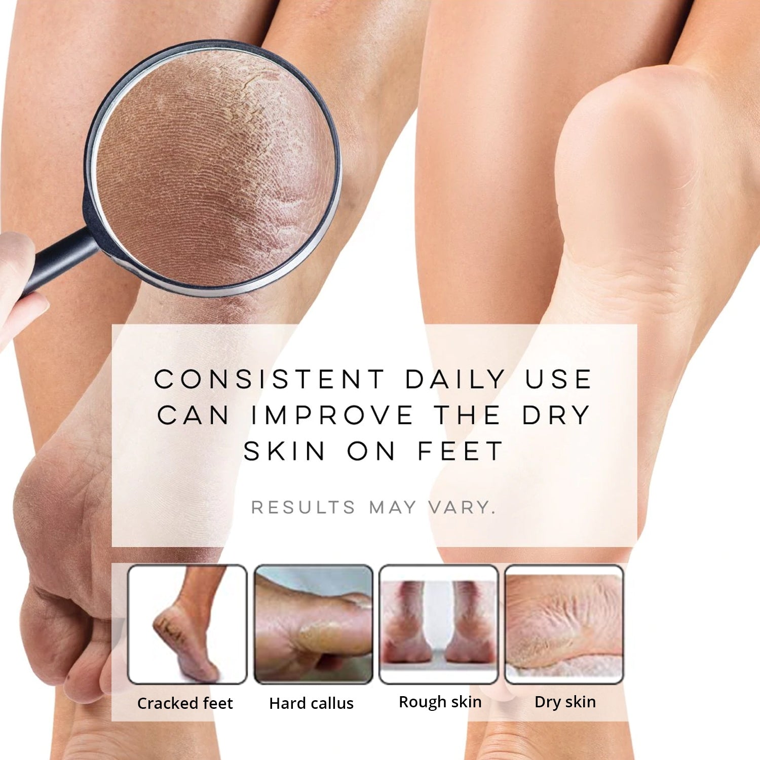 Breathable Toe Socks with Gel Cushioned Heel - Perfect for Running, Yoga & Diabetic Foot Care