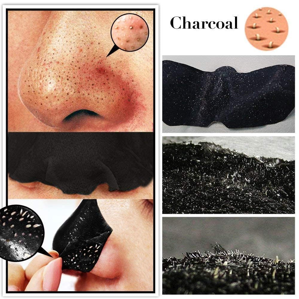 6-in-1 Blackhead & Whitehead Remover Tool - Professional Pimple Extractor, Acne Treatment & Pore Vacuum Cleaner for Men & Women (White/Black) | Perfect for Home Skincare & Facial Spa Treatment